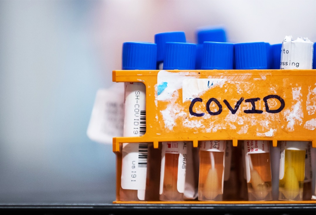 اگر اوضاع آنتاریو کنترل نشود، آمار ابتلا به کرونا  روزانه ۱۸ هزار نفر می شود